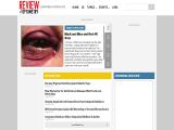 Review Of Optometry optometry slit